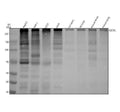 Anti-M6PR IGF2R Rabbit Monoclonal Antibody