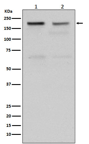Western blot analysis of Topoisomerase II alpha expression in (1) HeLa cell lysate; (2) Jurkat cell lysate.