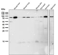 All lanes use the Antibody at 1:1K dilution for 1 hour at room temperature.