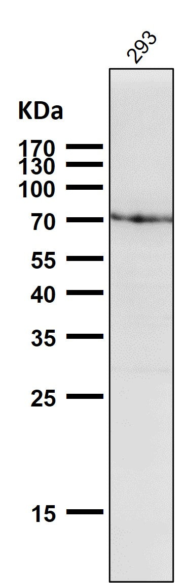 All lanes use the Antibody at 1:1K dilution for 1 hour at room temperature.