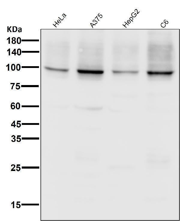 All lanes use the Antibody at 1:5W dilution for 1 hour at room temperature.