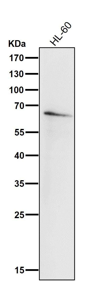 All lanes use the Antibody at 1:1K dilution for 1 hour at room temperature.