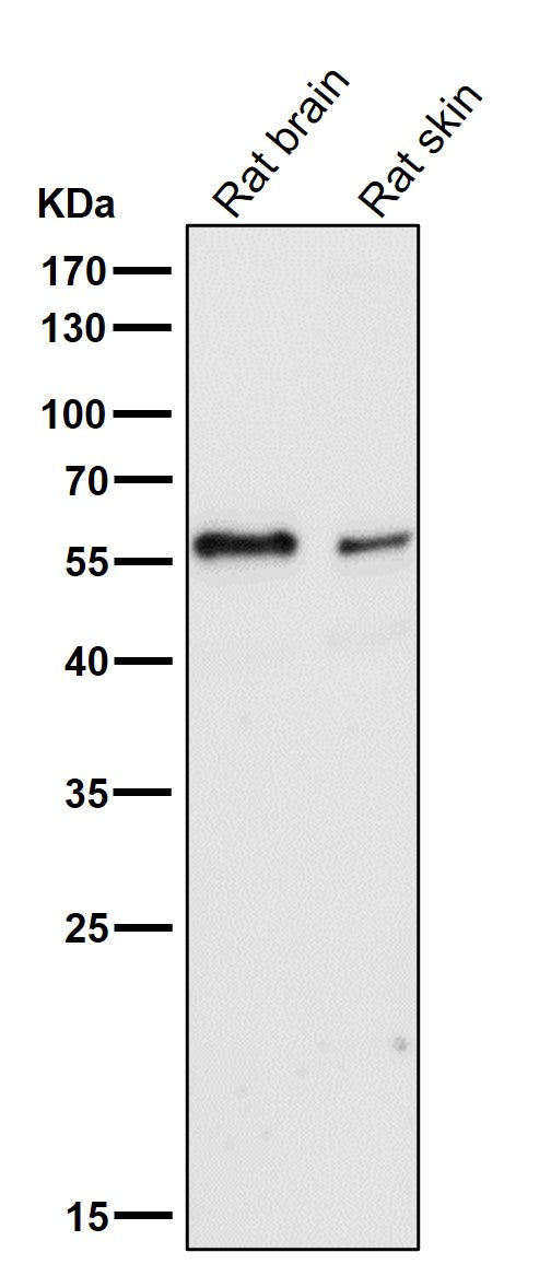 All lanes use the Antibody at 1:3K dilution for 1 hour at room temperature.
