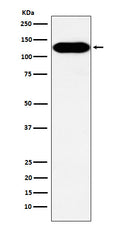 Western blot analysis of BCAR1 expression in A431 cell lysate.