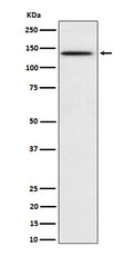 Western blot analysis of Phospho-BCAR1 (Y410) expression in HeLa treated with pervanadate cell lysate.