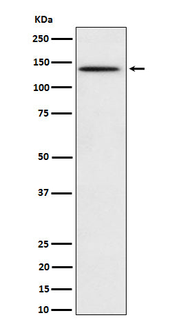 Western blot analysis of Phospho-BCAR1 (Y410) expression in HeLa treated with pervanadate cell lysate.