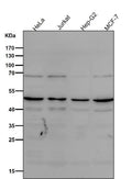 All lanes use the Antibody at 1:1K dilution for 1 hour at room temperature.
