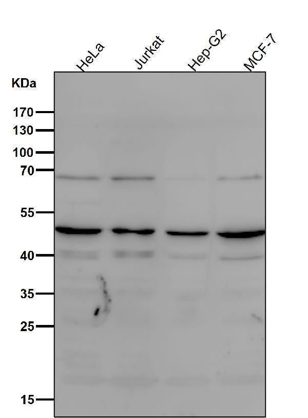 All lanes use the Antibody at 1:1K dilution for 1 hour at room temperature.