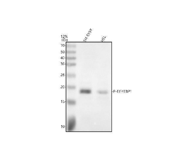 Anti-Phospho-eIF4EBP1 (T70) Rabbit Monoclonal Antibody