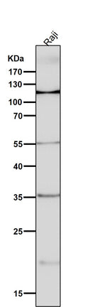 All lanes use the Antibody at 1:5K dilution for 1 hour at room temperature.