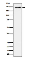 Western blot analysis of Phospho-LRP6 (S1490) expression in heLa treated with Calyculin cell lysate.