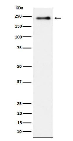 Western blot analysis of Phospho-LRP6 (S1490) expression in heLa treated with Calyculin cell lysate.