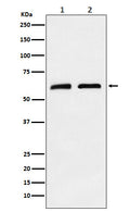 Western blot analysis of CLPX expression in (1) A673 cell lysate; (2) Mouse brain lysate.