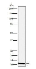 Western blot analysis of SPINK1 expression in Human pancreas lysate.
