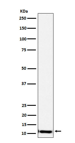 Western blot analysis of SPINK1 expression in Human pancreas lysate.