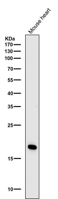 All lanes use the Antibody at 1:3K dilution for 1 hour at room temperature.