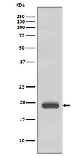Western blot analysis of Caveolin 3 expression in Human fetal heart lysate.