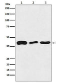 Western blot analysis of TDP43 expression in (1) HeLa cell lysate; (2) Mouse brain lysate; (3) Rat brain lysate.