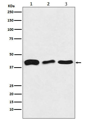 Western blot analysis of TDP43 expression in (1) HeLa cell lysate; (2) Mouse brain lysate; (3) Rat brain lysate.