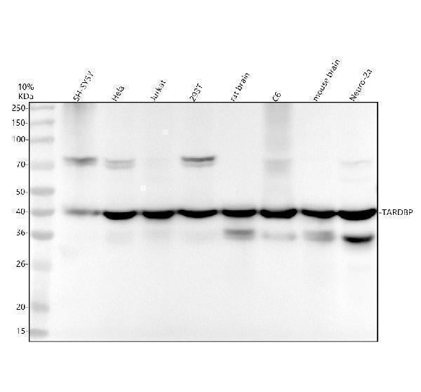 Anti-TDP43 TARDBP Rabbit Monoclonal Antibody