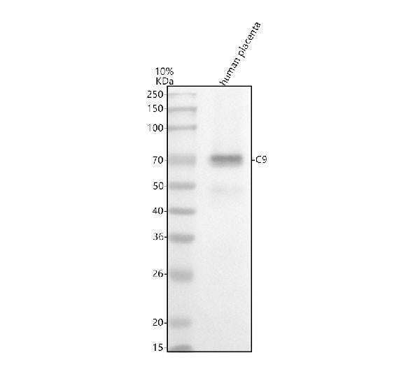 Anti-C9/Complement Component C9 Rabbit Monoclonal Antibody