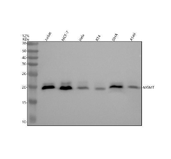Anti-MGMT Rabbit Monoclonal Antibody