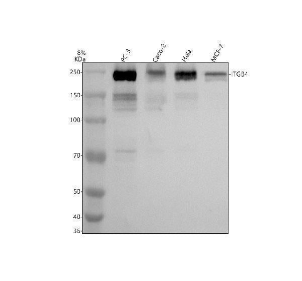 Anti-Integrin beta 4 ITGB4 Rabbit Monoclonal Antibody