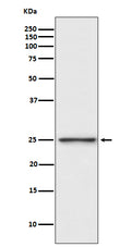 Western blot analysis of PGP9.5 expression in SH-SY5Y cell lysate.