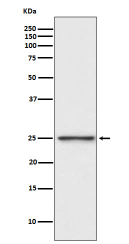 Western blot analysis of PGP9.5 expression in SH-SY5Y cell lysate.