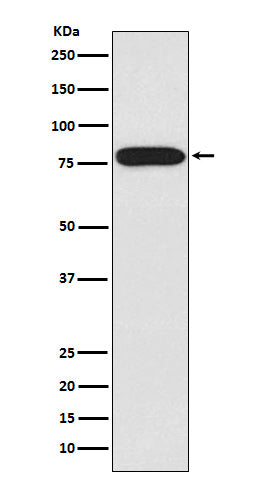 Western blot analysis of IRAK expression in HeLa cell lysate.