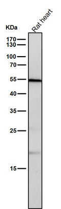 All lanes use the Antibody at 1:1K dilution for 1 hour at room temperature.