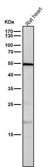 All lanes use the Antibody at 1:1K dilution for 1 hour at room temperature.
