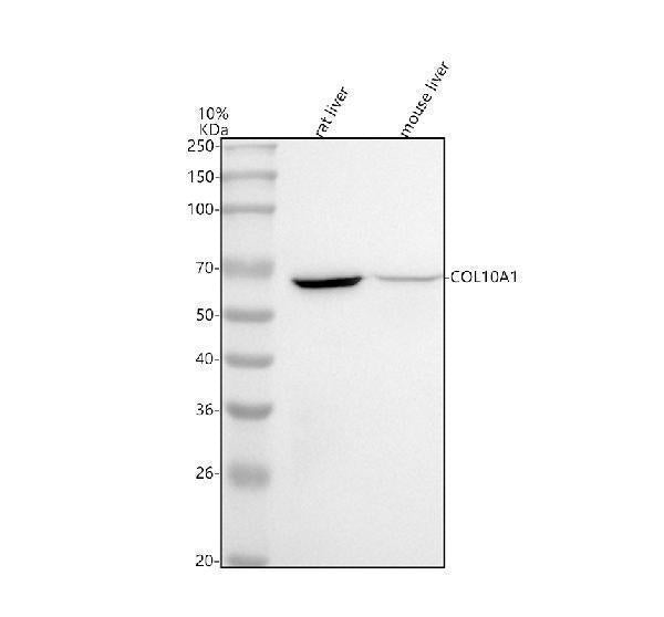 Anti-Collagen X COL10A1 Rabbit Monoclonal Antibody