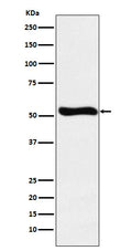 Anti-Lumican Rabbit Monoclonal Antibody