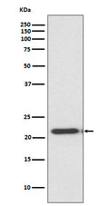 Anti-TIMP2 Rabbit Monoclonal Antibody