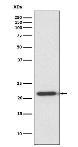 Anti-TIMP2 Rabbit Monoclonal Antibody
