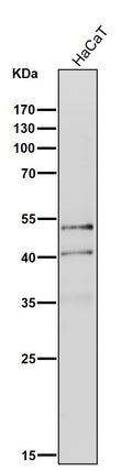 All lanes use the Antibody at 1:1K dilution for 1 hour at room temperature.