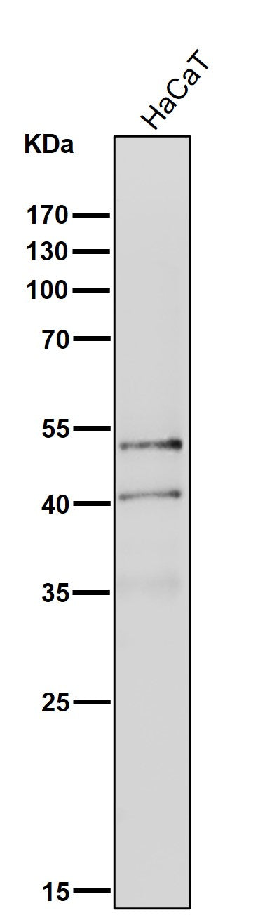 All lanes use the Antibody at 1:1K dilution for 1 hour at room temperature.