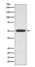 Western blot analysis of Endothelin B Receptor expression in 293T cell lysate.