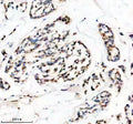 Anti-HMGA1 Rabbit Monoclonal Antibody