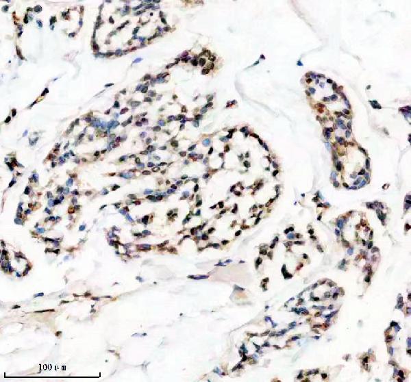 Anti-HMGA1 Rabbit Monoclonal Antibody