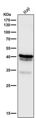 All lanes use the Antibody at 1:3K dilution for 1 hour at room temperature.