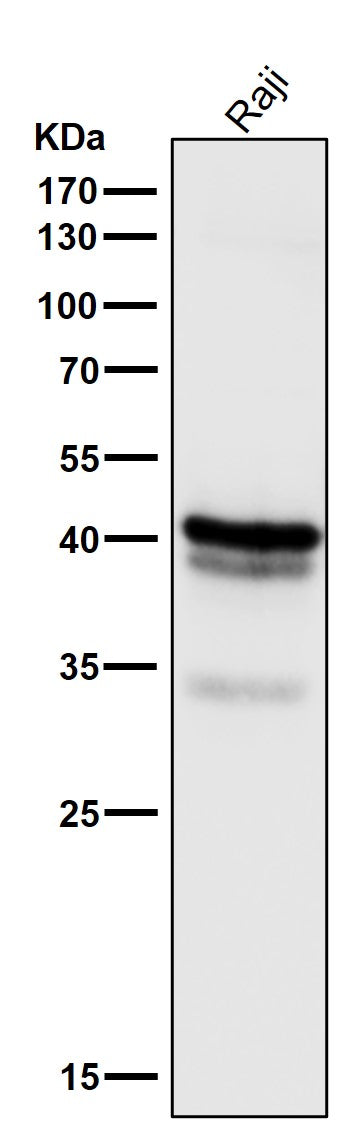 All lanes use the Antibody at 1:3K dilution for 1 hour at room temperature.
