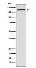 Western blot analysis of EHMT2/G9A expression in HeLa cell lysate.