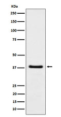 Western blot analysis of HDGF expression in A549 cell lysate.