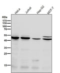All lanes use the Antibody at 1:1K dilution for 1 hour at room temperature.