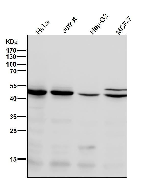 All lanes use the Antibody at 1:1K dilution for 1 hour at room temperature.