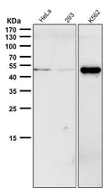 All lanes use the Antibody at 1:1K dilution for 1 hour at room temperature.