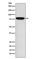 Western blot analysis of RANK expression in Human fetal liver lysate.