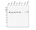 Anti-Methylmalonyl Coenzyme A mutase Antibody Picoband® (monoclonal, 2D6)